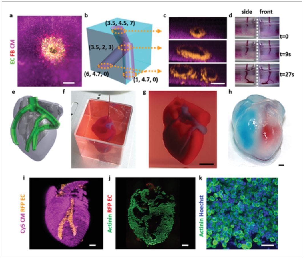 Израильские ученые впервые распечатали сердце целиком на 3D-принтере